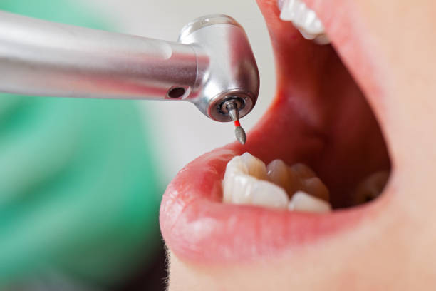 Best Broken or Chipped Tooth Repair in Bayside Gardens, OR